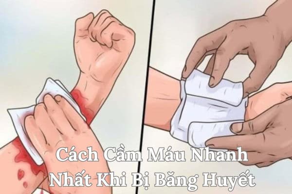 Cầm máu