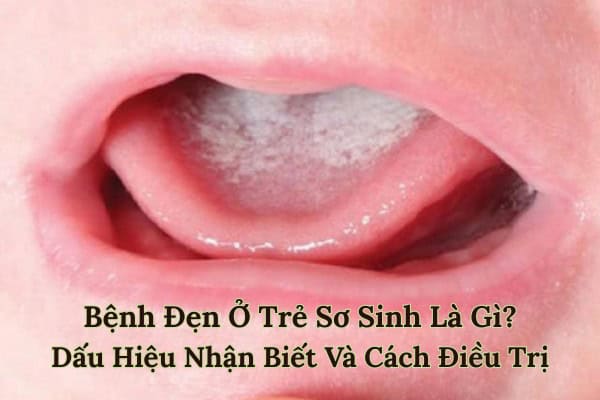 đẹn