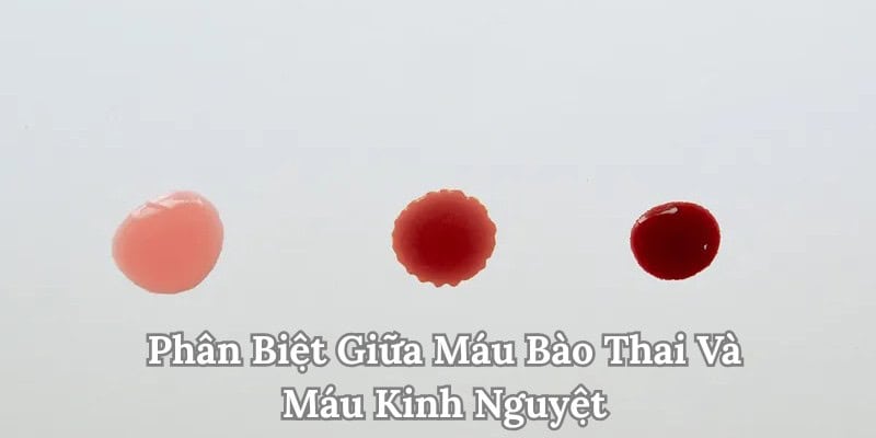 Máu