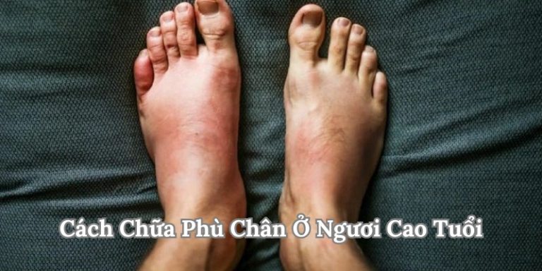 Phù