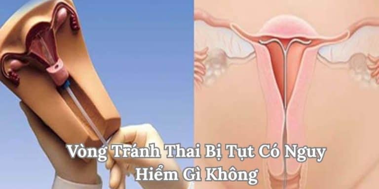 Vòng