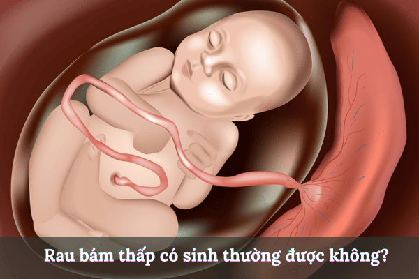 Thêm tiêu đề 2025 08 04t191225.615