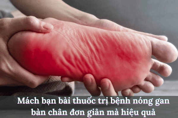 Thêm tiêu đề 2025 08 04t192715.582