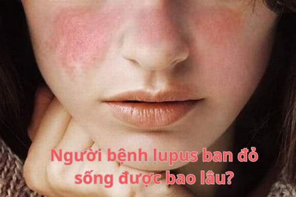 Bệnh