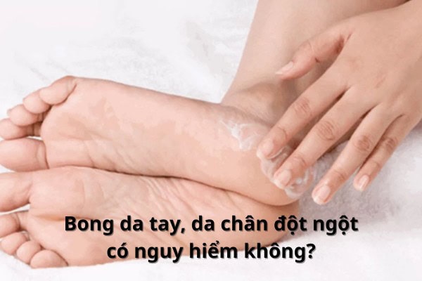 Da