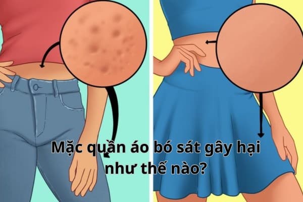 Quần