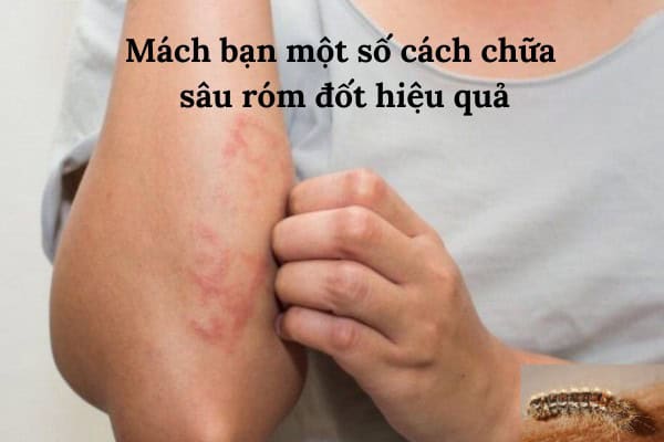 Sa