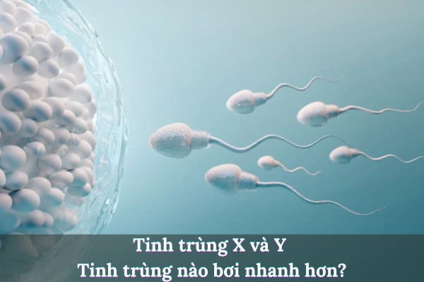 Ti