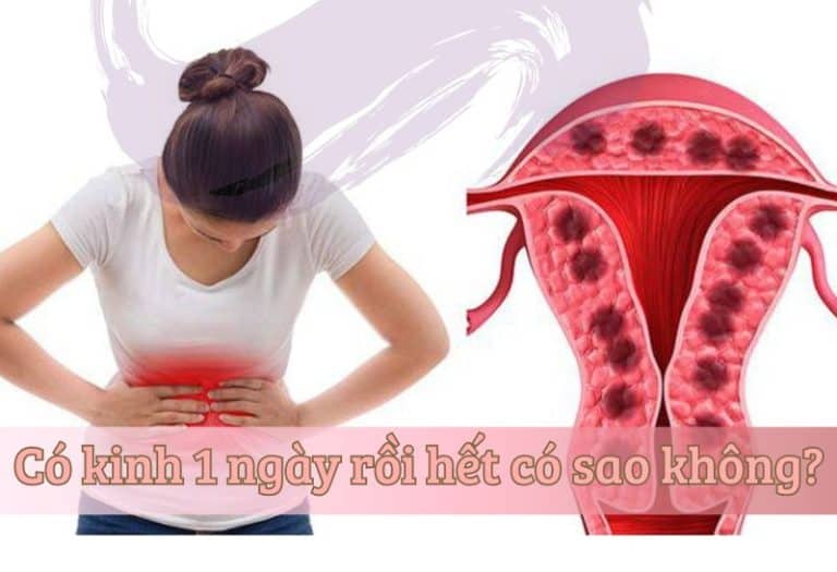Có kinh 1 ngày rồi hết có sao không