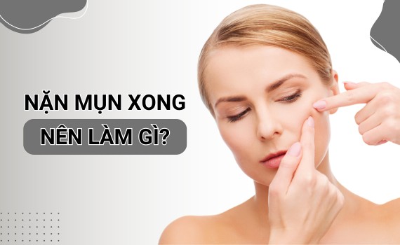 Mới nặn mụn nên làm gì